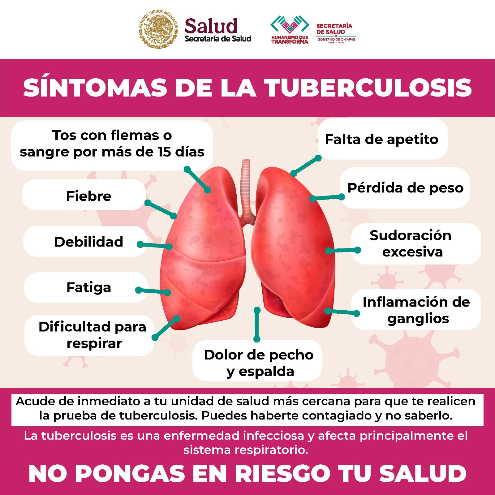 Infografía: Síntomas de la Tuberculosis